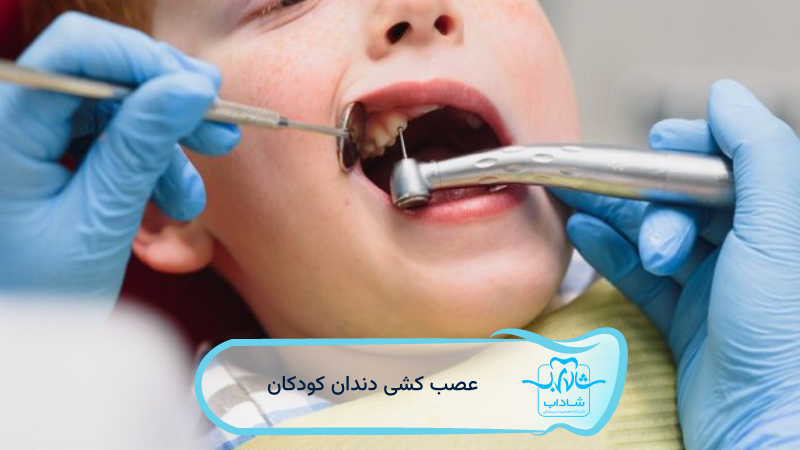 عصب‌-کشی-دندان-کودکان
