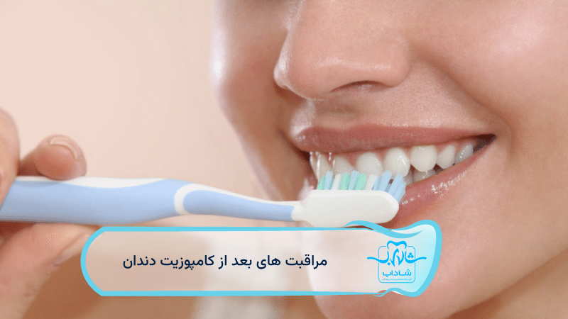 مراقبت-های-بعد-از-کامپوزیت-دندان