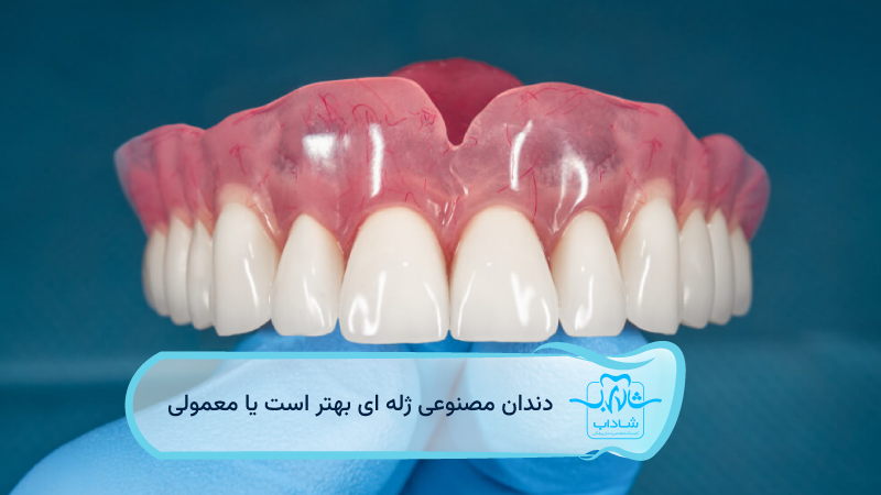 دندان-مصنوعی-ژله-ای-بهتر-است-یا-معمولی