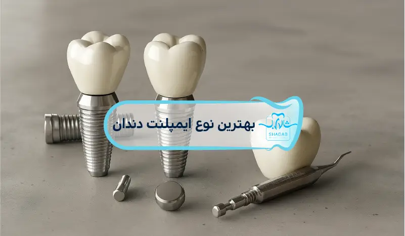 بهترین-نوع-ایمپلنت-دندان