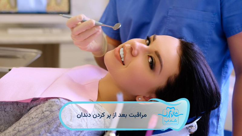مراقبت-بعد-از-پر-کردن-دندان