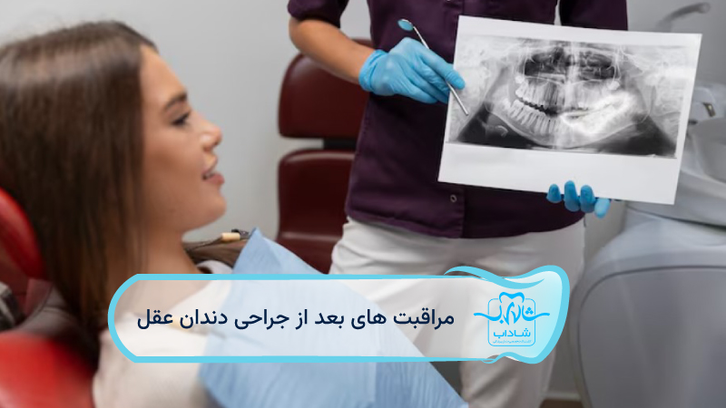 مراقبت-های-بعد-از-جراحی-دندان-عقل