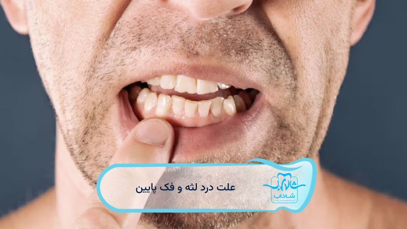 علت-درد-لثه-و-فک-پایین