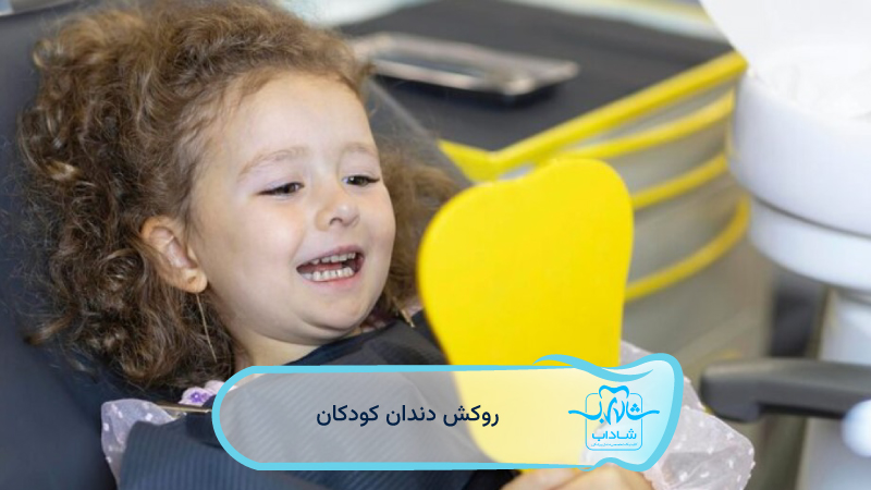 روکش-دندان-کودکان