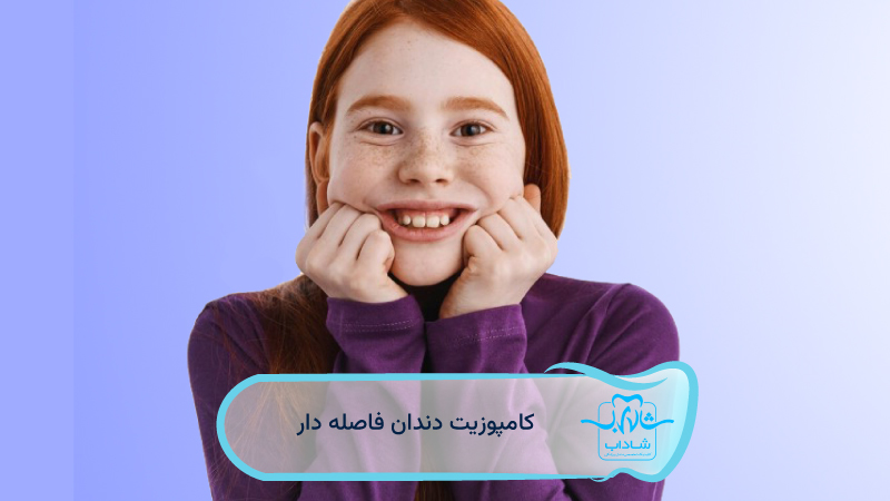 کامپوزیت-دندان-فاصله-دار