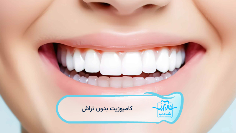 کامپوزیت-بدون-تراش