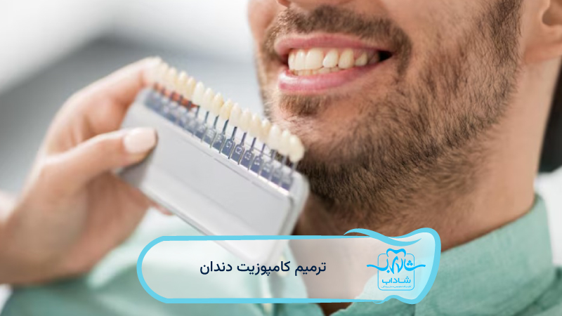 ترمیم-کامپوزیت-دندان