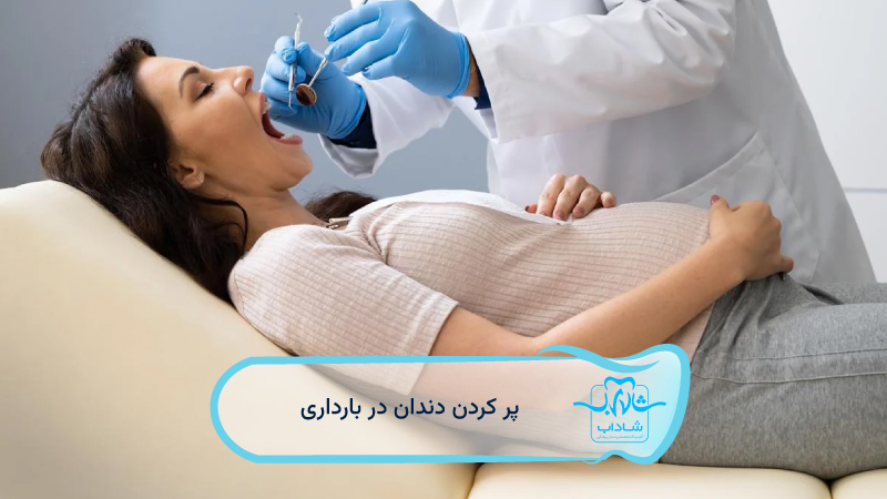 پر-کردن-دندان-در-بارداری