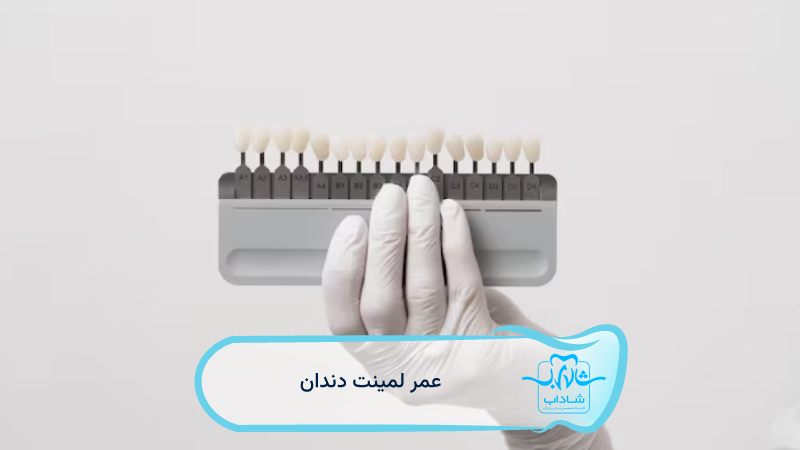 عمر-لمینت-دندان