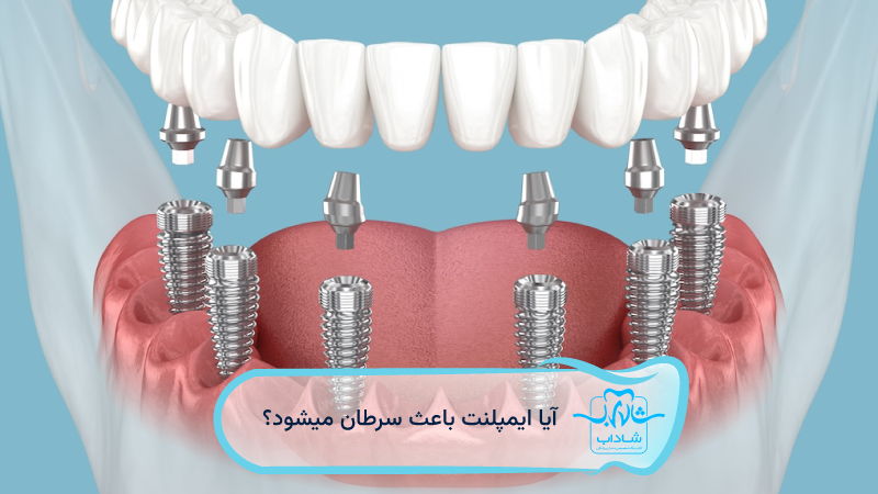 آیا-ایمپلنت-باعث-سرطان-میشود