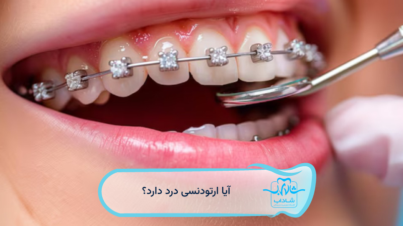 -آیا-ارتودنسی-درد-دارد