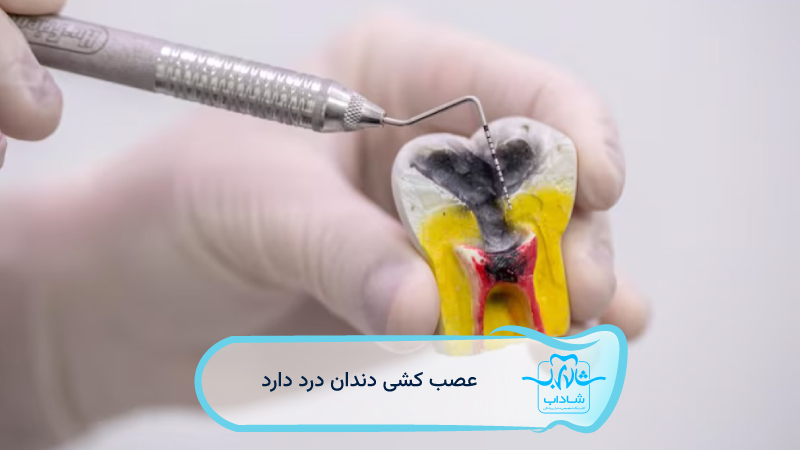 عصب-کشی-دندان-درد-دارد