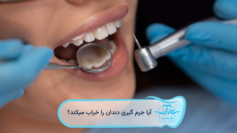 آیا-جرم-گیری-دندان-را-خراب-میکند