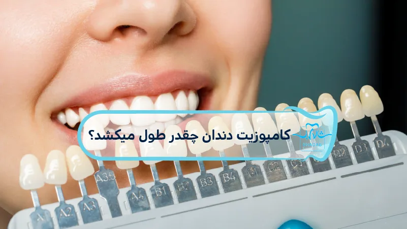 کامپوزیت-دندان-چقدر-طول-میکشد
