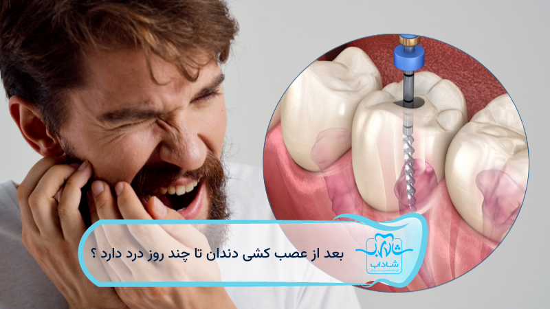 بعد-از-عصب-کشی-دندان-تا-چند-روز-درد-دارد
