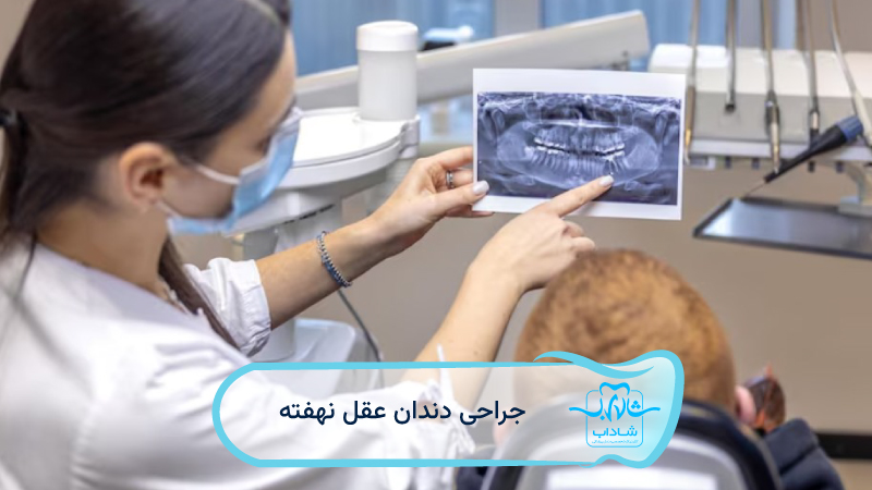 جراحی-دندان-عقل-نهفته