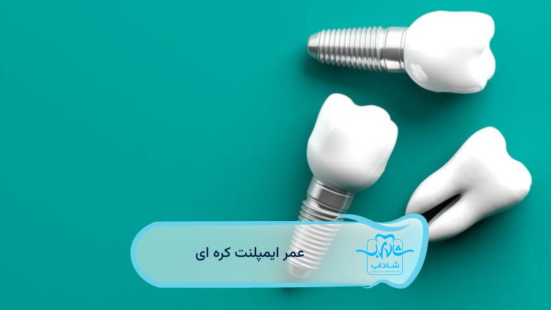 عمر-ایمپلنت-کره-ای