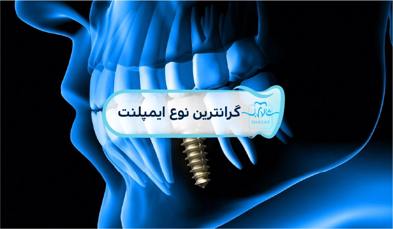 گرانترین-نوع-ایمپلنت