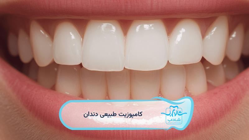 کامپوزیت-طبیعی