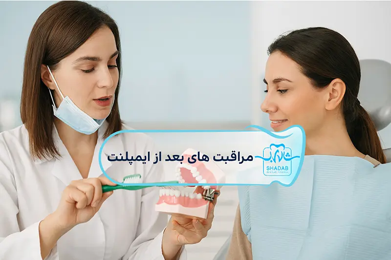 مراقبت-های-بعد-از-ایمپلنت