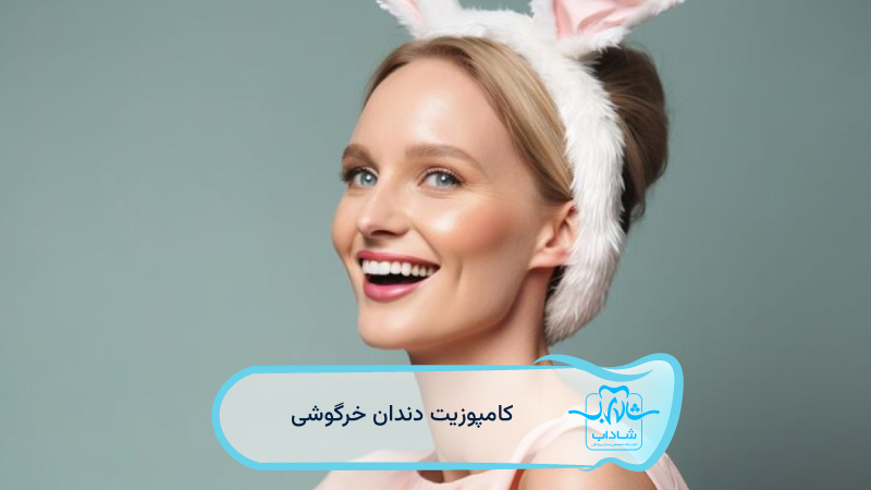 کامپوزیت-دندان-خرگوشی