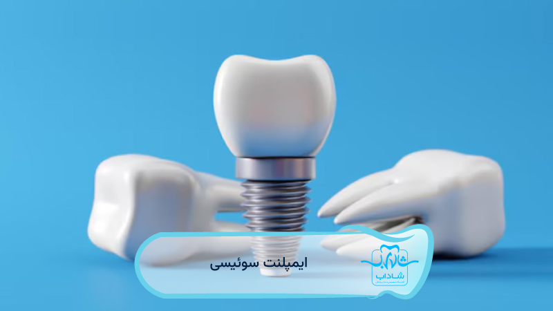 ایمپلنت-سوئیسی