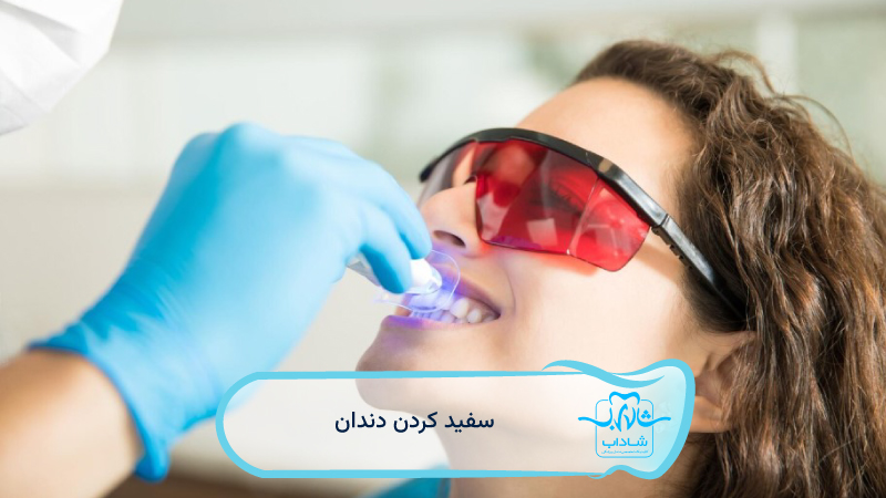 سفید-کردن-دندان