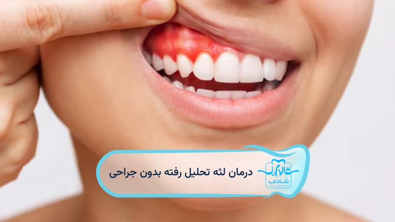 درمان-لثه-تحلیل-رفته-بدون-جراحی