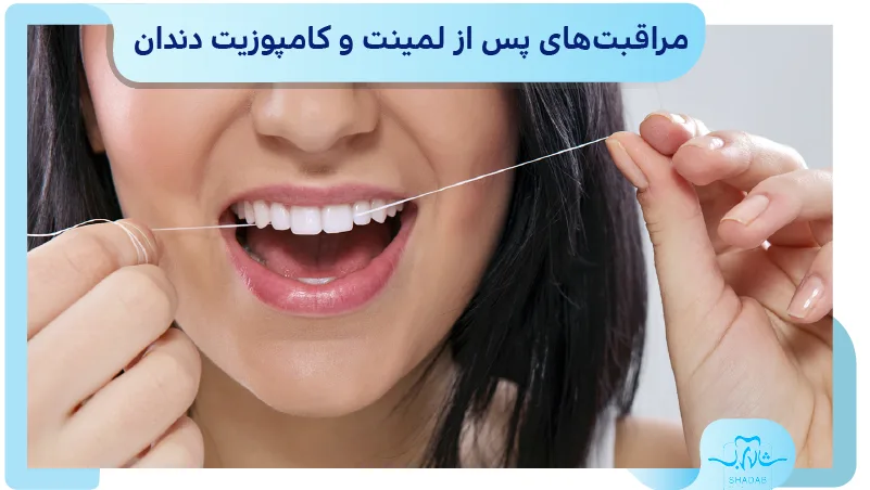 مراقبت&zwnj;های پس از لمینت و کامپوزیت دندان