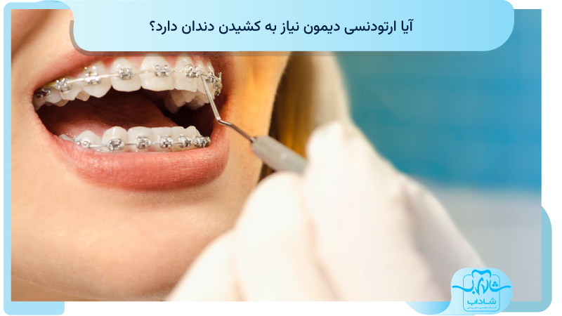 آیا ارتودنسی دیمون نیاز به کشیدن دندان دارد؟