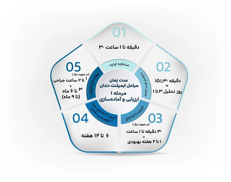 مدت زمان آماده سازی برای ایمپلنت