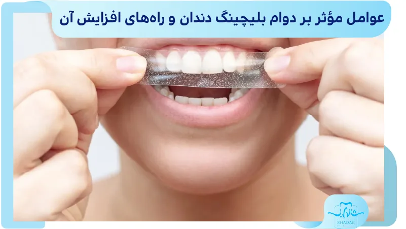 عوامل مؤثر بر دوام بلیچینگ دندان و راه&zwnj;های افزایش آن