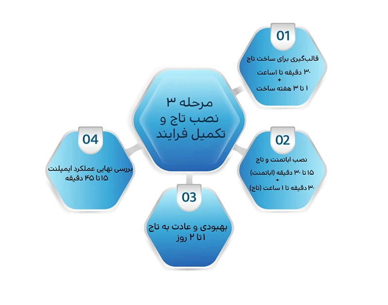 مدت زمان نصب تاج و تکمیل ایمپلنت دندان