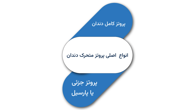 انواع اصلی پروتز متحرک دندان