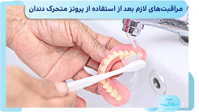 مراقبت&zwnj;های لازم بعد از استفاده از پروتز متحرک دندان