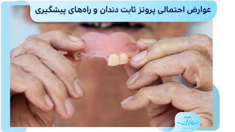 عوارض احتمالی پروتز ثابت دندان و پیشگیری