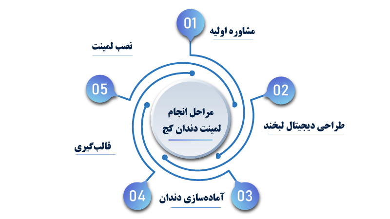 مراحل انجام لمینت دندان کج