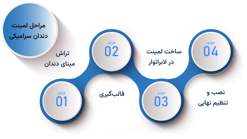 مراحل لمینت دندان سرامیکی