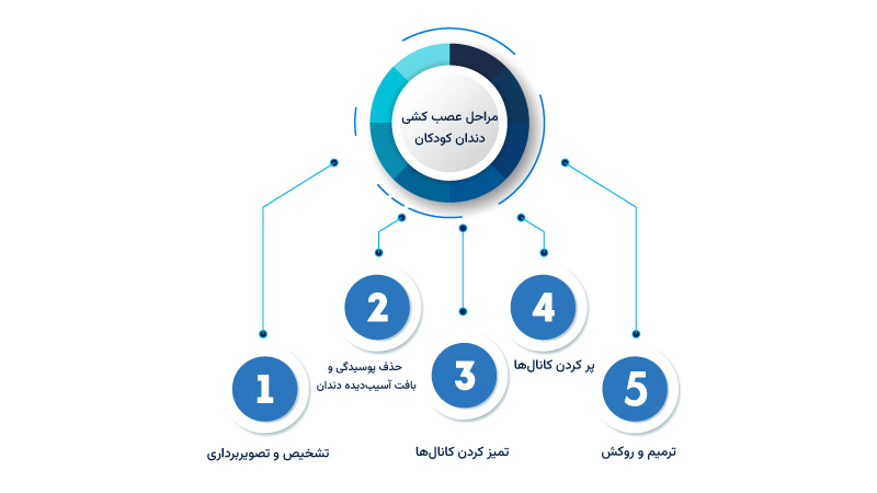 مراحل عصب کشی دندان کودکان
