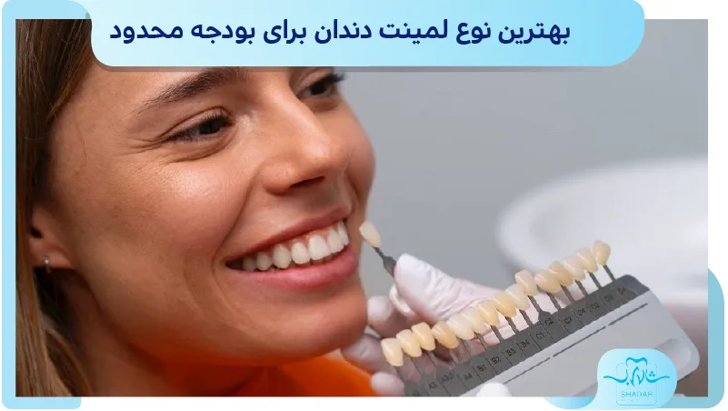 بهترین نوع لمینت دندان برای بودجه محدود
