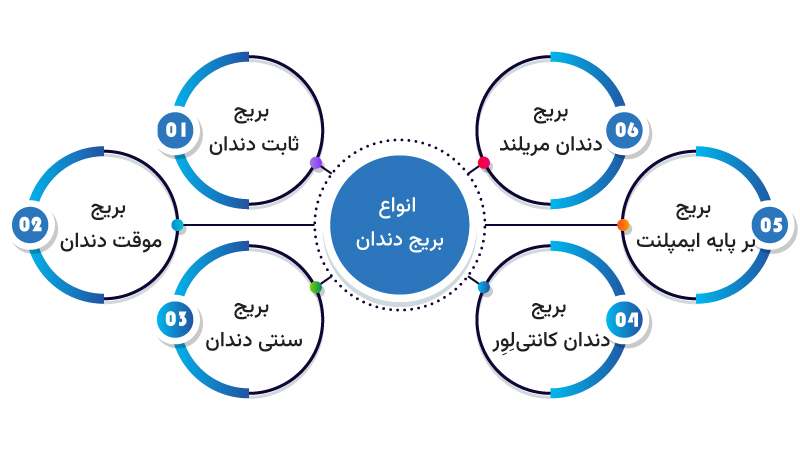 انواع بریج دندان