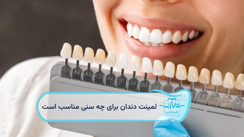 لمینت-دندان-برای-چه-سنی-مناسب-است