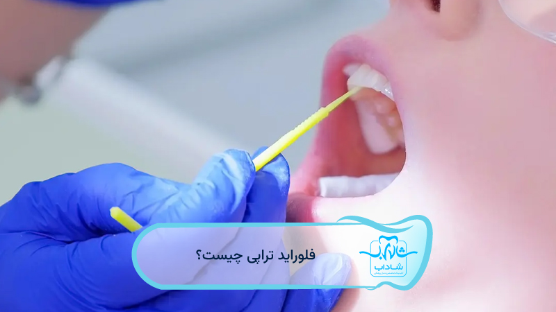 فلوراید-تراپی-چیست