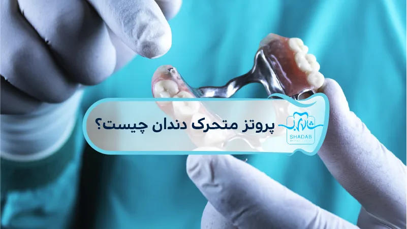 پروتز-متحرک-دندان-چیست؟
