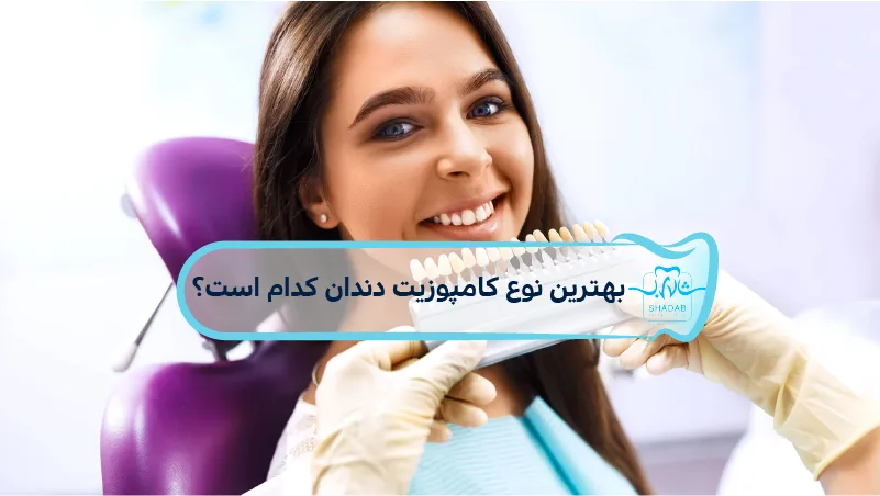 بهترین-نوع-کامپوزیت-دندان-چیست؟